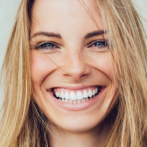 Beautiful smile at Smile Arc Dental Group in San Diego, CA